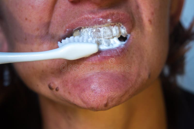 Foaming Mouth Photos - Free & Royalty-Free Stock Photos from Dreamstime Foaming Mouth Photos - Free & Royalty-Free Stock Photos from Dreamstime