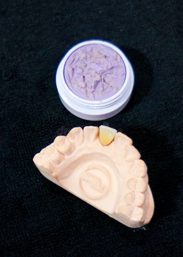 Closeup of Human Upper Jaw Denture Mold Stock Photo Image of form