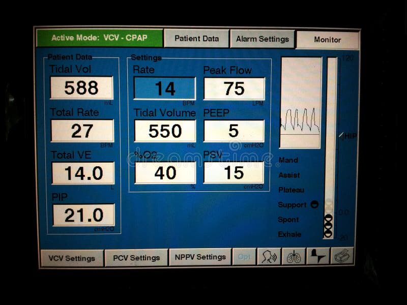 Closeup of a Mechanical Ventilator,s Control Panel Stock Photo Image