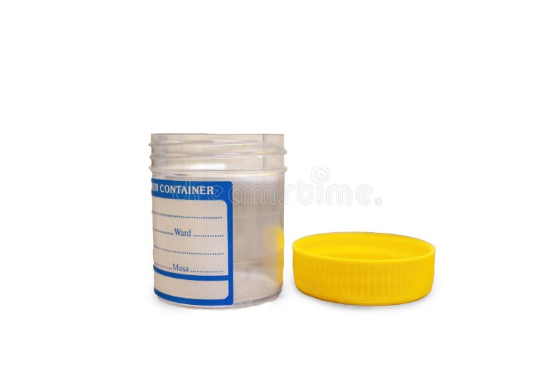 A Specimen Container for Lab Test Stock Photo Image of epidemic