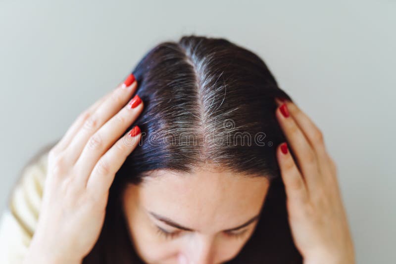 Closeup of Woman S Head with Parted Gray Hair Regrown Roots Becouse of  Quarantine. Female Show Her Grey Hair Stock Photo - Image of hairline,  showing: 235967160