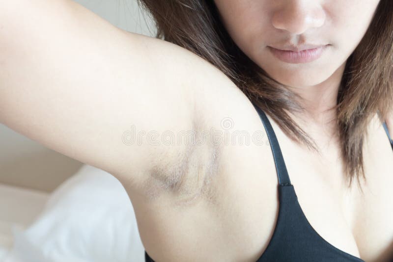 Closeup woman problem black armpit with bedroom background for skin care and beauty concept. Problem wrinkle stock images, royalty-free photos and pictures