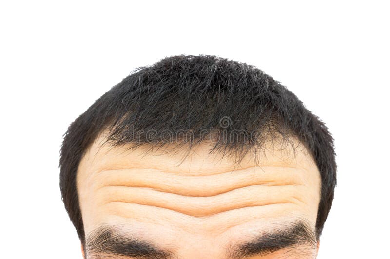 Closeup Wrinkles on Forehead Young Man, Hair Loss for Health Car Stock Photo - Image of head, beauty: 79560444 Closeup Wrinkles on Forehead Young Man, Hair Loss for Health Car Stock Photo - Image of head, beauty: 79560444