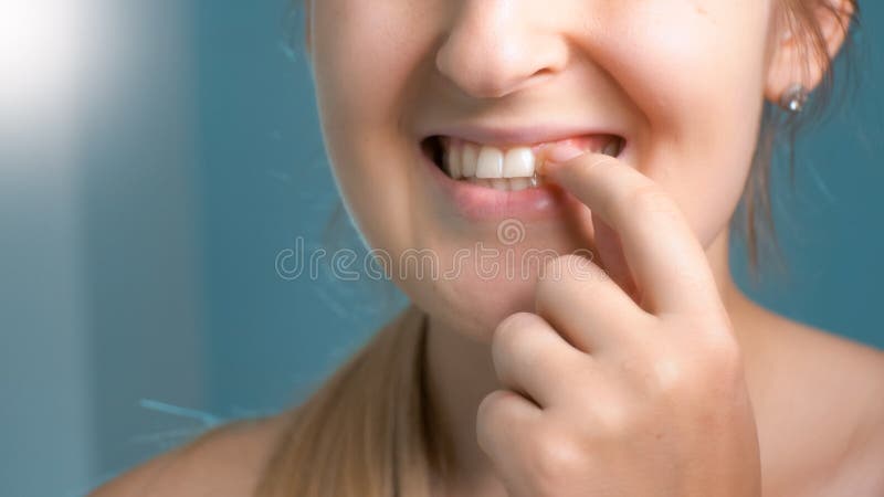 Closeupfoto av den unga kvinnan som trycker på hennes perfekta vita tänder på spegeln royaltyfri bild Closeupfoto av den unga kvinnan som trycker på hennes perfekta vita tänder på spegeln royaltyfri bild