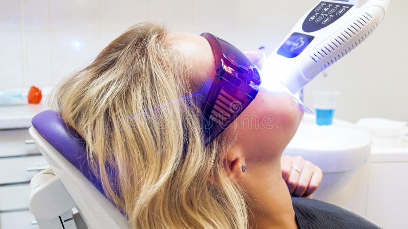 Closeupstående av den unga kvinnan som gör vit hennes tänder med UV ljus i tand- klinik arkivbild Closeupstående av den unga kvinnan som gör vit hennes tänder med UV ljus i tand- klinik arkivbild
