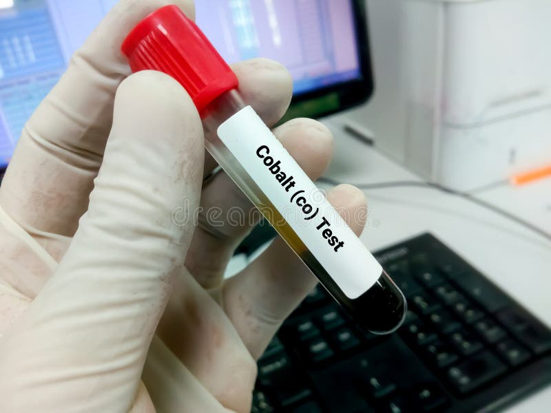 Cobalt (CO) Test. Toxic Cardiomyopathy Stock Photo Image of hand, chemical 275614080