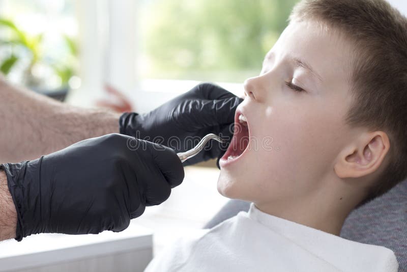 Coglitura del dente di latte Il ragazzo sta sedendosi su una sedia dentaria Il dentista in guanti di gomma neri tiene la leva lat fotografie stock libere da diritti Coglitura del dente di latte Il ragazzo sta sedendosi su una sedia dentaria Il dentista in guanti di gomma neri tiene la leva lat fotografie stock libere da diritti