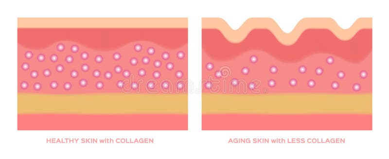 Colagênio no gráfico mais novo da pele e do envelhecimento ilustração do vetor Colagênio no gráfico mais novo da pele e do envelhecimento ilustração do vetor