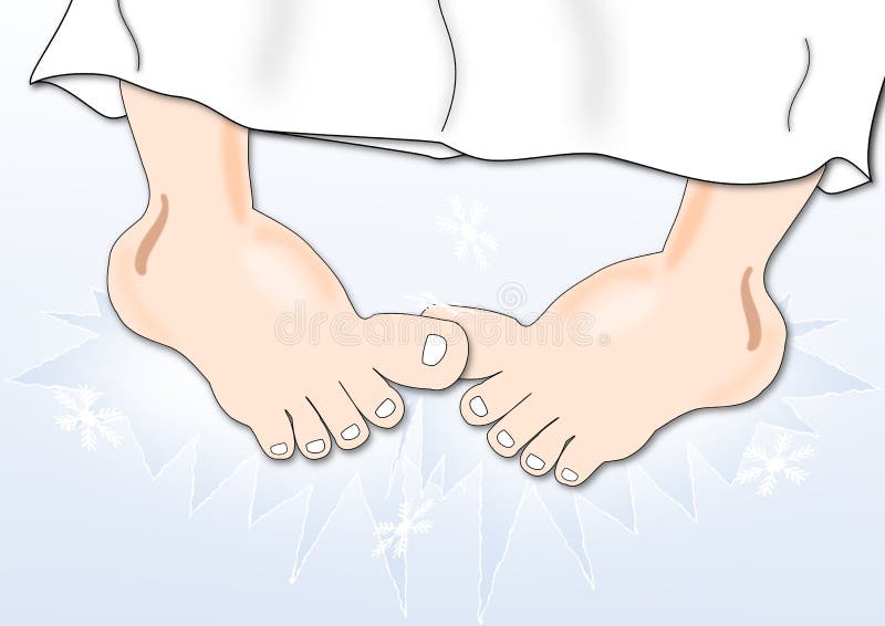 Cold Feet stock illustration. Illustration of bare, standing 19532753