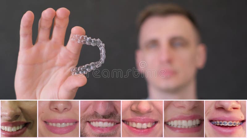 Collage de video de personas con una hermosa sonrisa. clínica dental almacen de video