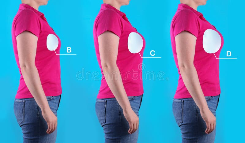 Implant Sizes Stock Photos - Free & Royalty-Free Stock Photos from