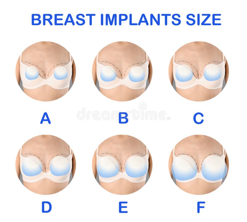 Breast Augmentation Sizing System