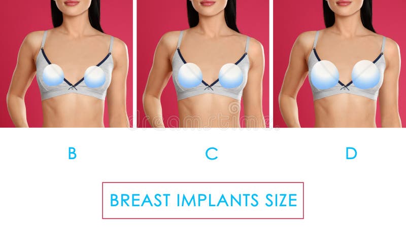 Implant Sizes Stock Photos - Free & Royalty-Free Stock Photos from