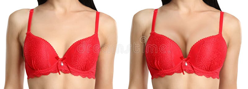 Collage with Photos of Young Woman before and after Breast Size Correction  on White Background, Closeup. Banner Design Stock Image - Image of  background, enlargement: 216647601