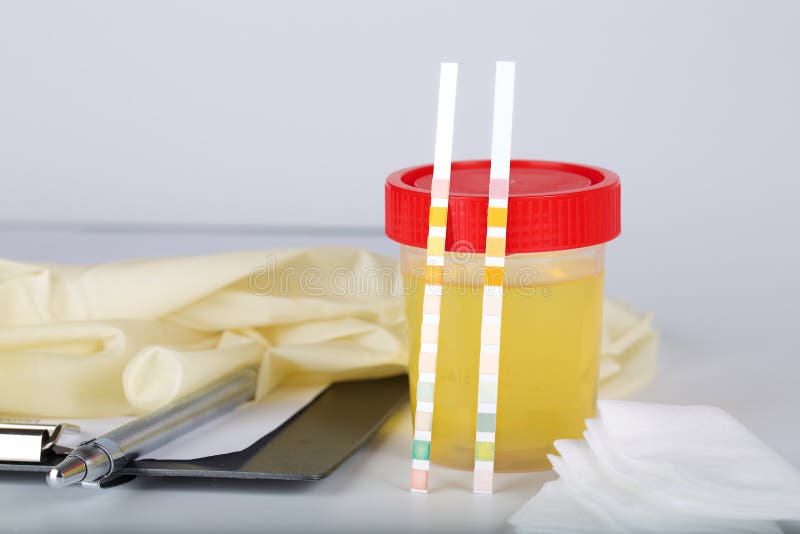 Collection Cup with Urine Test on a Table of a Lab Technician. Stock
