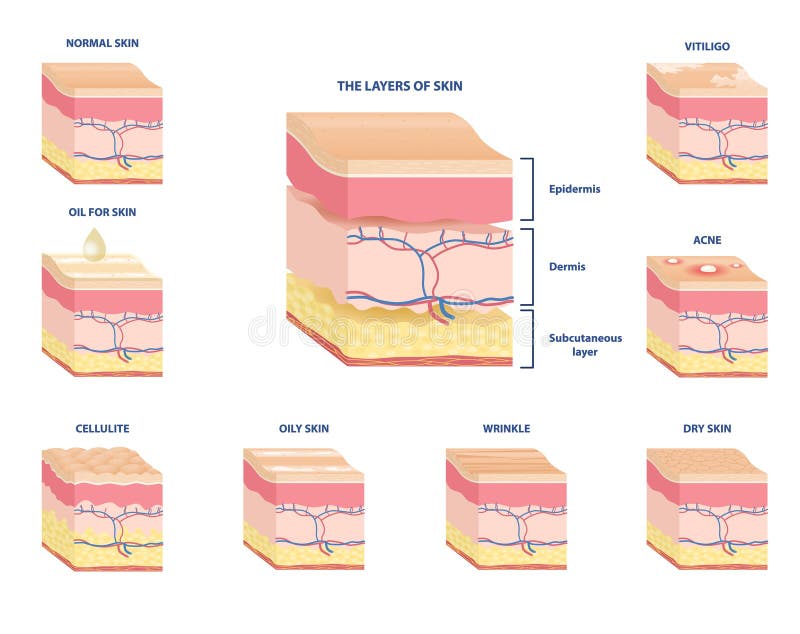 Some type of skin. Дерматология схемы. Skin Types. Скин слой.