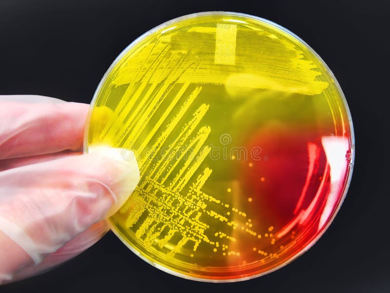 Colonia bacteriana el patógeno en una placa de la raya del agar en un laboratorio/un laboratorio médicos/de ciencia