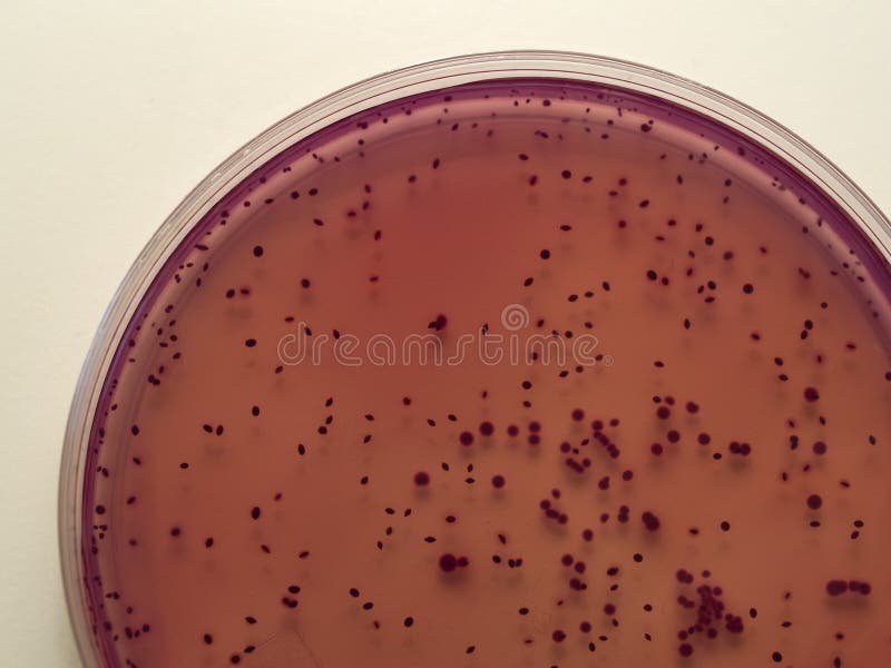 Colonias bacterianas