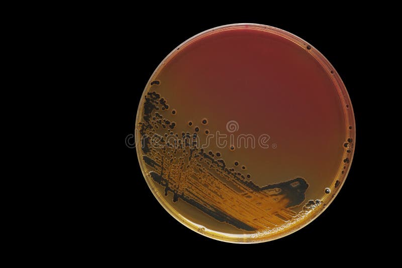 Colonias bacterianas negras de especies de las salmonelas en las salmonelas Shi