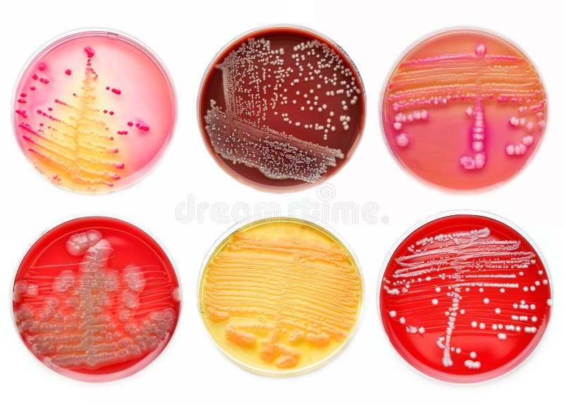 Colonias de las bacterias