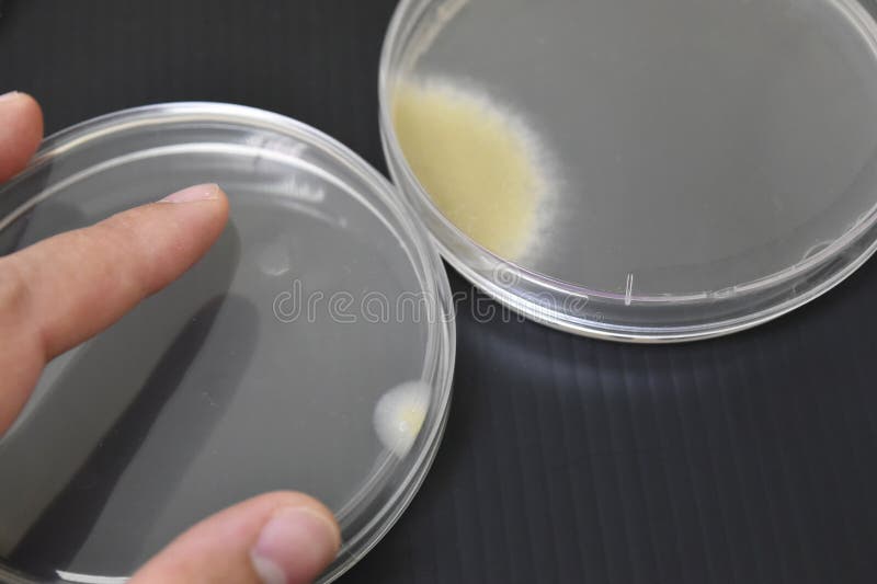 Colonies of Bacteria Growth on Agar Plate Medium in Laboratory Stock ...