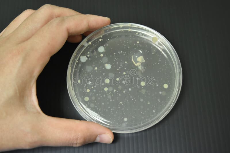 Colonies of Bacteria Growth on Agar Plate Medium Stock Image Image of