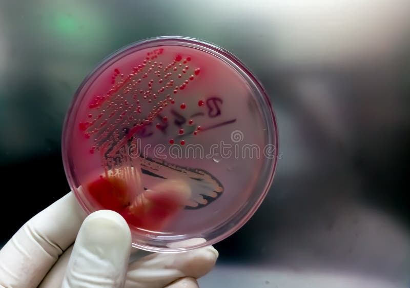 Colonies of Bacteria in MacConkey Agar (culture Medium Plate). Petri