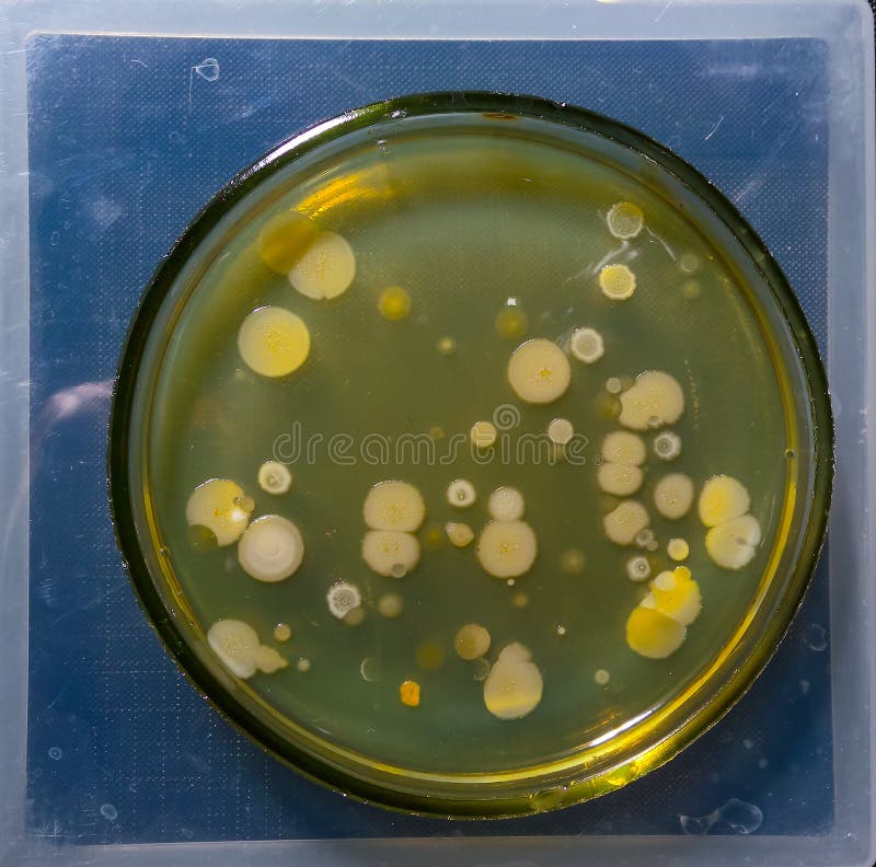 Colonies of Pathogenic Bacteria in a Petri Dish, Microbiological