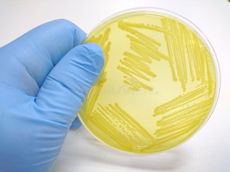Colony of Bacteria in Culture Medium Plate Stock Image Image of