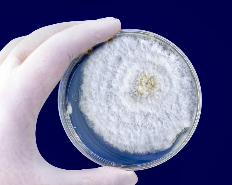 207 Black Mold Petri Dish Stock Photos Free & RoyaltyFree Stock Photos from Dreamstime