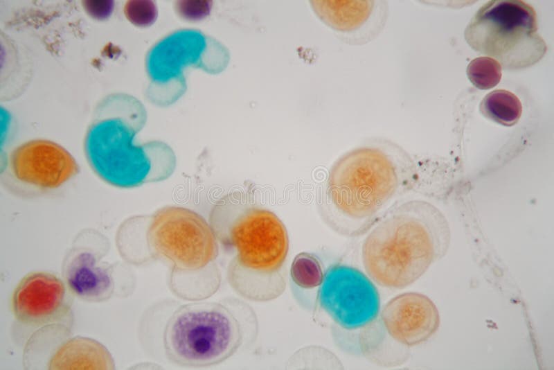 Pollen Grains of Different Species Under the Microscope Stock Photo