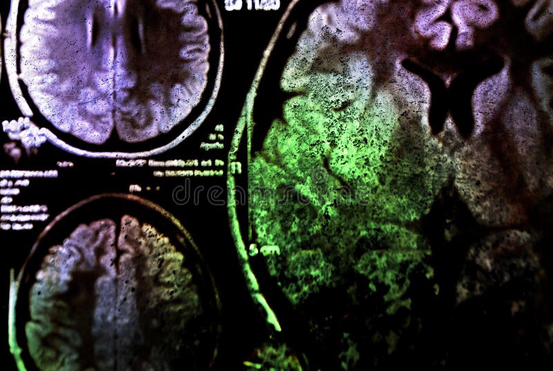 Colorful x-ray scan of brain background