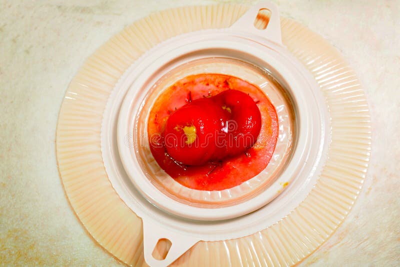 308 Colostomy Stock Photos Free & RoyaltyFree Stock Photos from