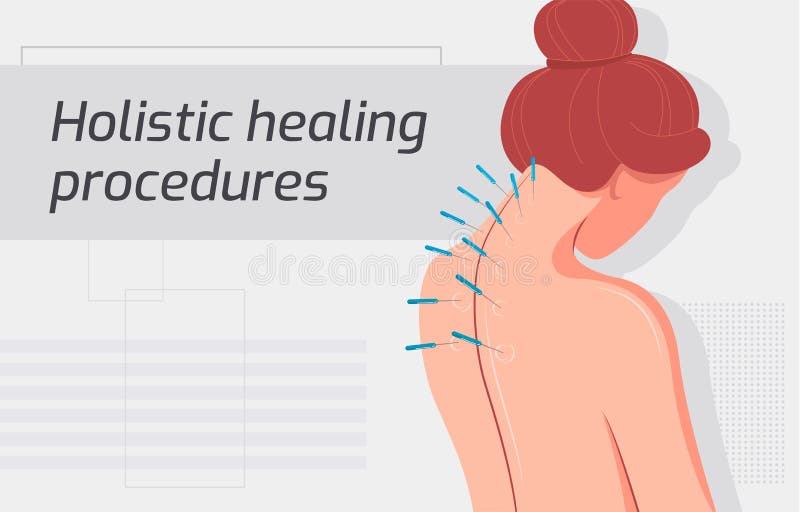 Vector flat vector illustration of medical procedure stock illustration Vector flat vector illustration of medical procedure stock illustration