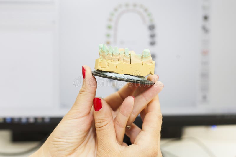 Comparing 3d dental scan with dental prosthetic mold. Comparing a 3d dental scan with dental prosthetic mold stock photos Comparing 3d dental scan with dental prosthetic mold. Comparing a 3d dental scan with dental prosthetic mold stock photos