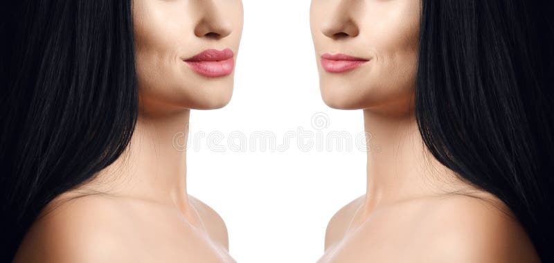 Comparison of female lips before and after filler injections beauty plastic. Beautiful perfect woman lips with natural makeup royalty free stock photography Comparison of female lips before and after filler injections beauty plastic. Beautiful perfect woman lips with natural makeup royalty free stock photography