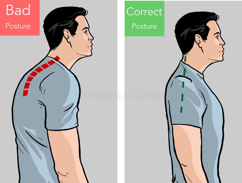 Comparison of man with good and bad back posture. Male suffer from scolisosis from sedentary work. Vector illustration. stock illustration