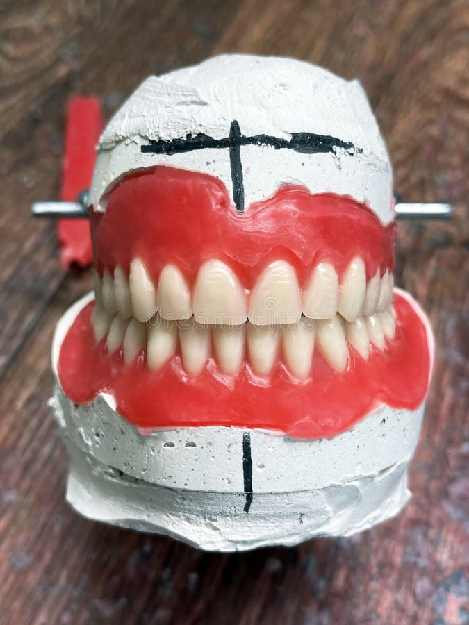 Complete Removable Dental Prostheses on Gypsum Models. Natural Full