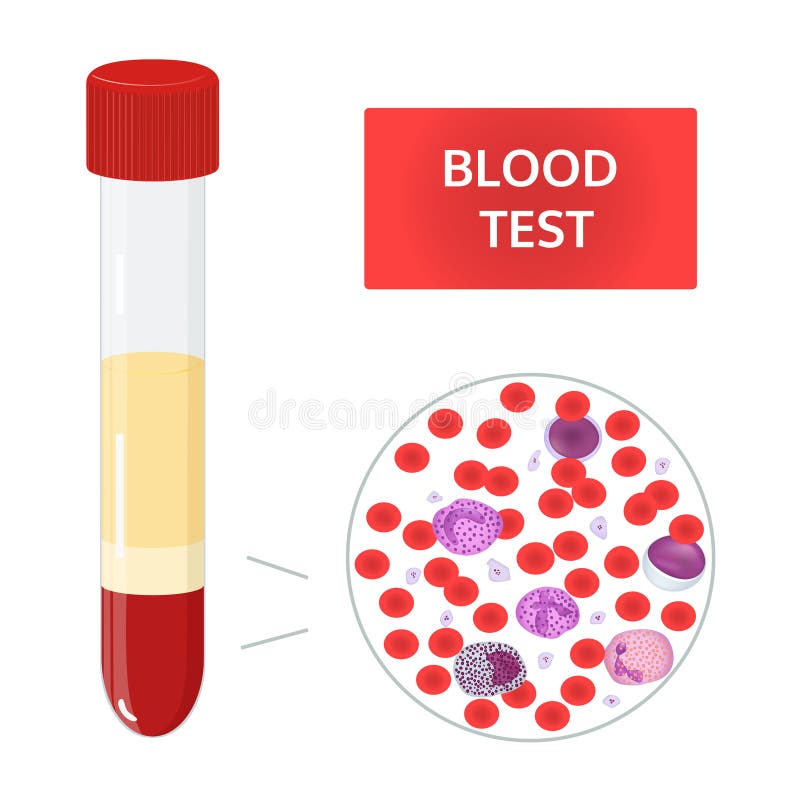 Composición de la opinión del blood? debajo del microscopio Tubo de ensayo Imagen del vector libre illustration Composición de la opinión del blood? debajo del microscopio Tubo de ensayo Imagen del vector libre illustration