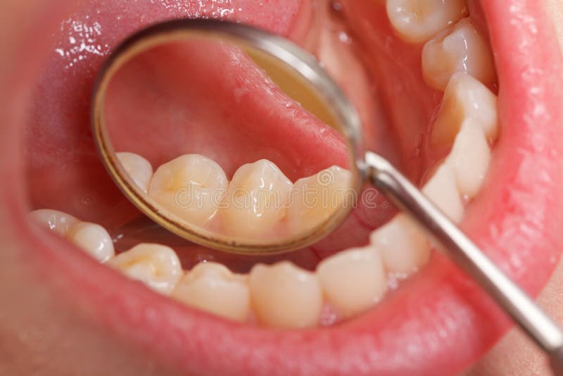 Dental Exam stock photo. Image of conceptual, hygiene, dental 322388