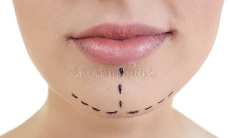 Conceito da cirurgia plástica Retrato da mulher bonita imagem de stock Conceito da cirurgia plástica Retrato da mulher bonita imagem de stock