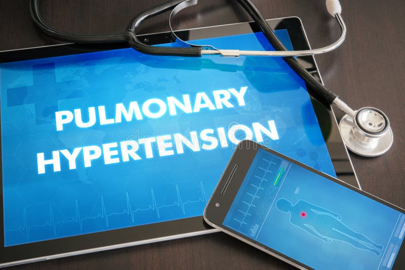 Pulmonary hypertension (heart disorder) diagnosis medical concept on tablet screen with stethoscope. Pulmonary hypertension (heart disorder) diagnosis medical concept on tablet screen with stethoscope.