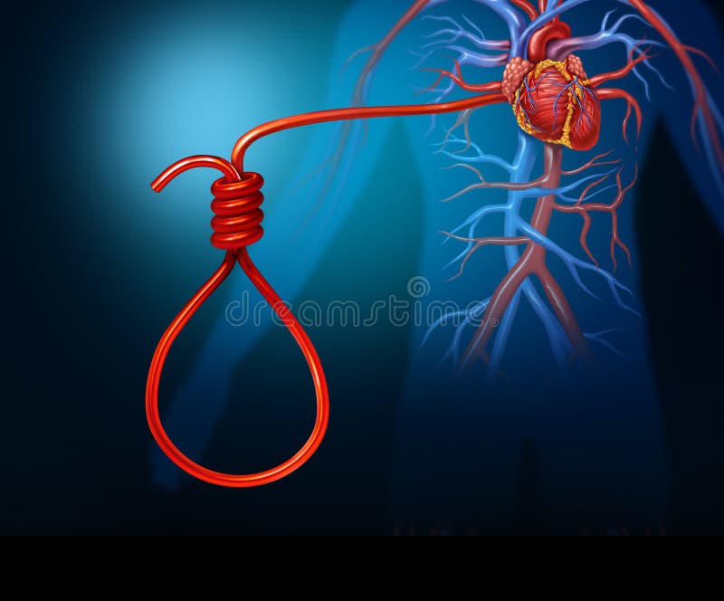 Concept de crise cardiaque illustration stock Concept de crise cardiaque illustration stock