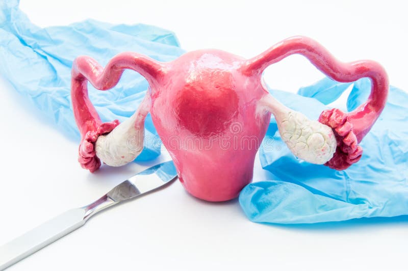 Concept of gynecology surgery. 3D model of female uterus is near scalpel and medical gloves. Surgery in gynecology and operation o royalty free stock photo Concept of gynecology surgery. 3D model of female uterus is near scalpel and medical gloves. Surgery in gynecology and operation o royalty free stock photo
