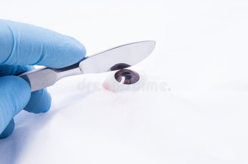 Concept photo of eye surgery. Eye surgeon holding scalpel over model of eye on operating table. Eye surgery and vision correction