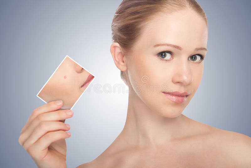 Concept skincare . Skin of beautywoman royalty free stock image Concept skincare . Skin of beautywoman royalty free stock image