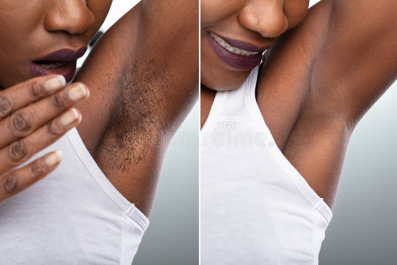 Should men shave their armpit hair? » WITHIN NIGERIA