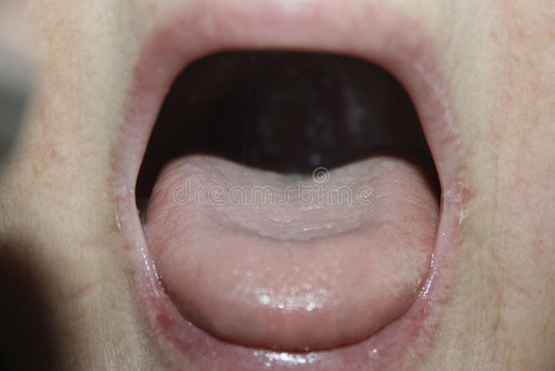 Concepto del dolor de la lengua de gripe y de frío imagen de archivo libre de regalías Concepto del dolor de la lengua de gripe y de frío imagen de archivo libre de regalías