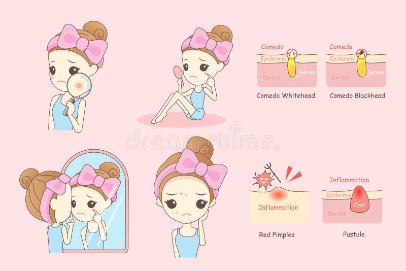Concepto del problema de la cara de la mujer libre illustration Concepto del problema de la cara de la mujer libre illustration