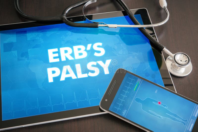 Erb's palsy (neurological disorder) diagnosis medical concept on tablet screen with stethoscope. Erb's palsy (neurological disorder) diagnosis medical concept on tablet screen with stethoscope.